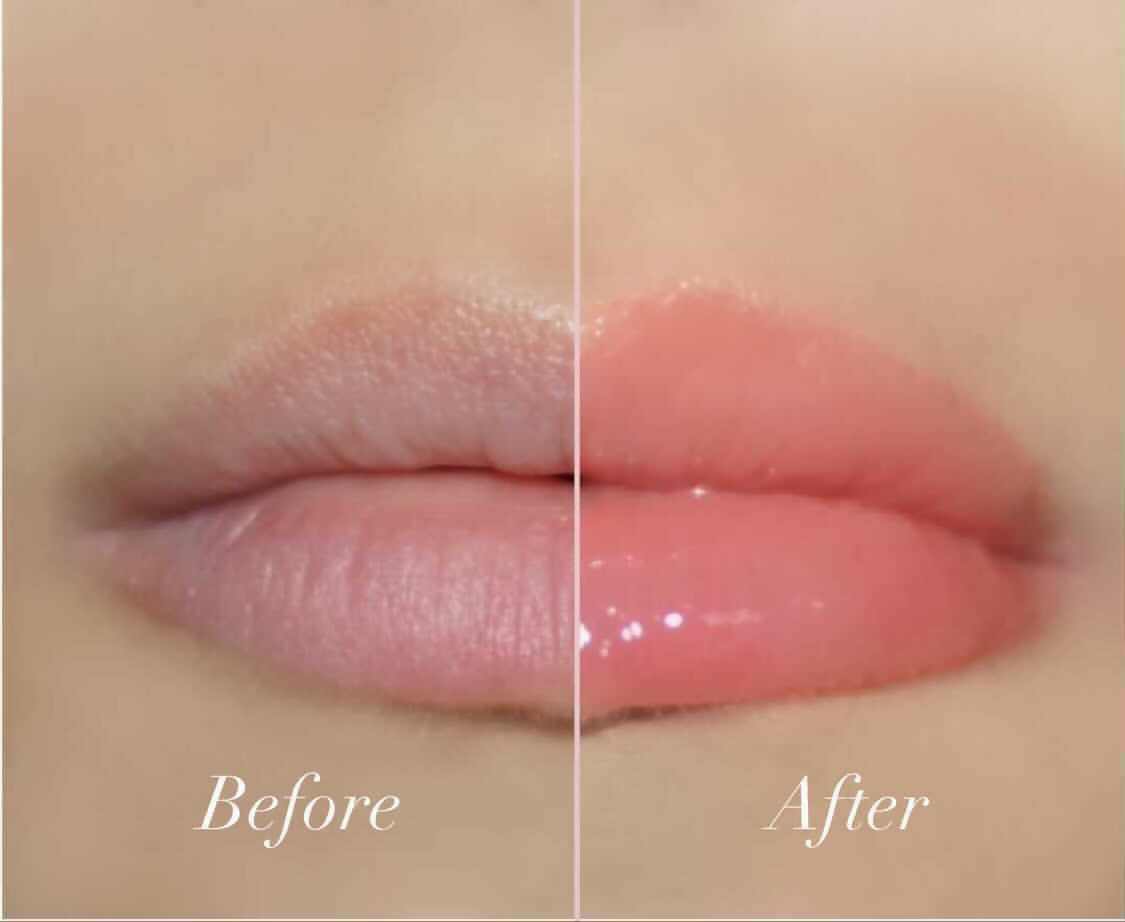 TulipLips