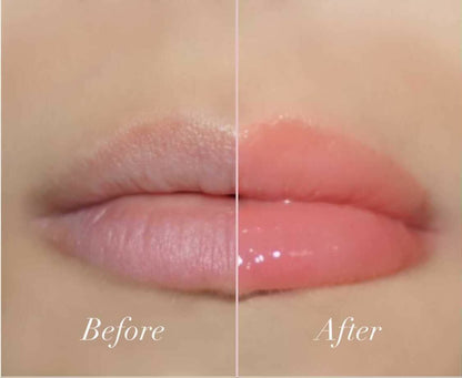 TulipLips