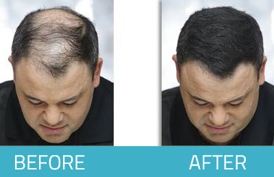 Hair in Seconds Hair Fibers