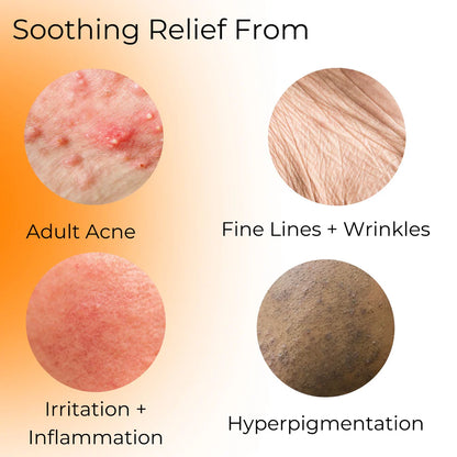 Soft Immersion Night Moisturizer - 1oz